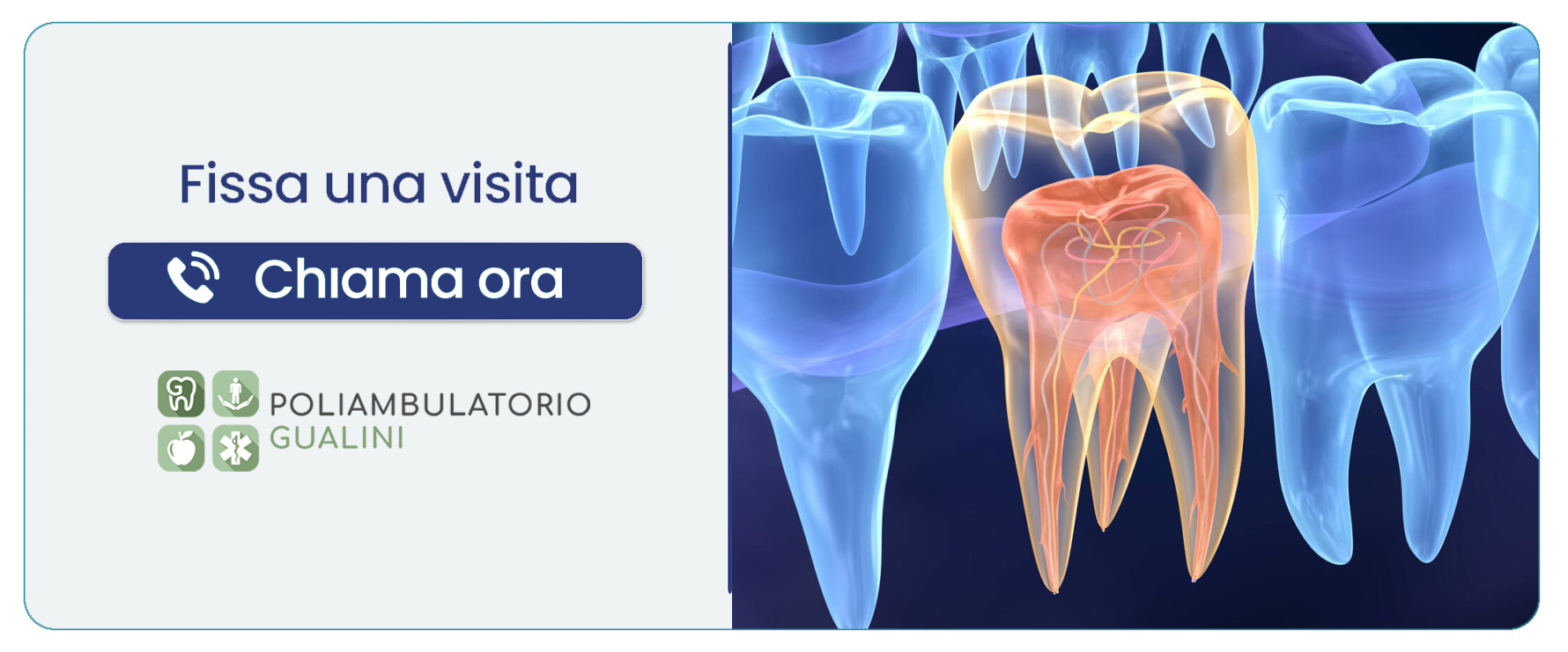 endodonzia-trattamento-endodontico Rogno (Bergamo)